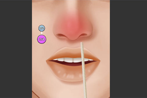 Nose Hospitalのゲーム画面